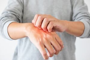  خارش پوست نشانه کدام بیماری‌ها هستند؟