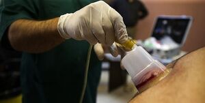  حجامت برای چه افرادی مجاز است؟