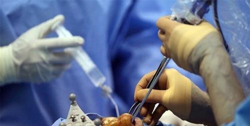  اولین عمل بینی در ایران را چه کسی انجام داد؟