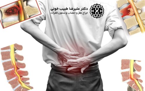  اینفوگرافیک/ ۶ دشمن ستون فقرات