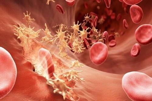 مواد خوراکی مفید برای کاهش غلظت خون 