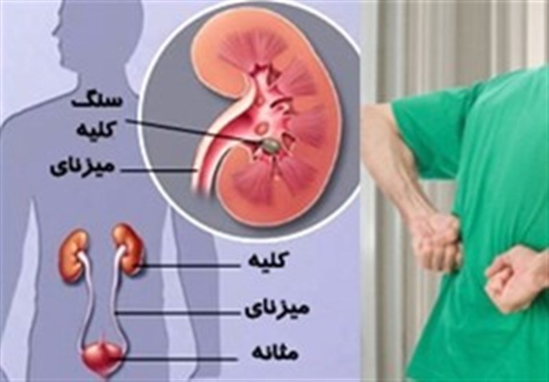 علائم اولیه اختلالات کلیوی!