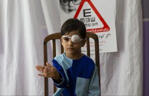  تنبلی چشم موجب نابینایی می‌شود؟