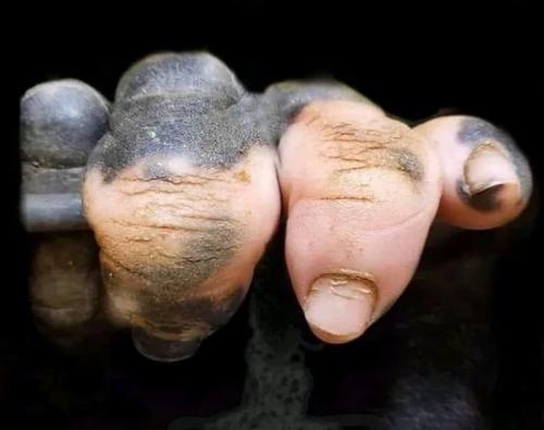تصویری عجیب از دست یک گوریل مبتلا به پیسی