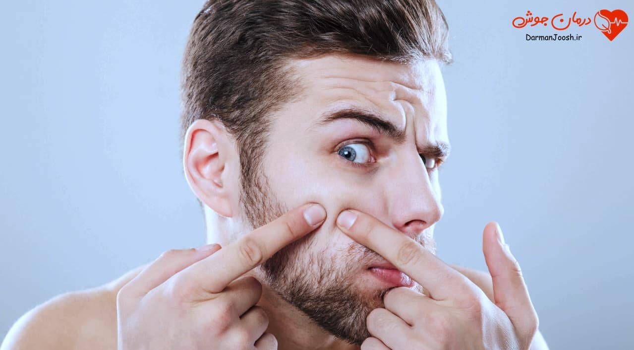 با جای جوش‌ها چه کنیم؟