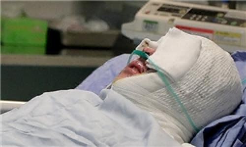 اسید پاشی بر روی متهم و مأمور کلانتری/فوری