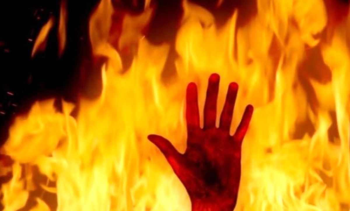  مردی برای حل مکعب روبیک خود را به آتش کشید!