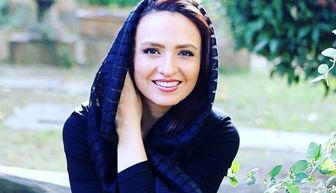 تغییر چهره گلاره عباسی همه را غافلگیر کرد! 