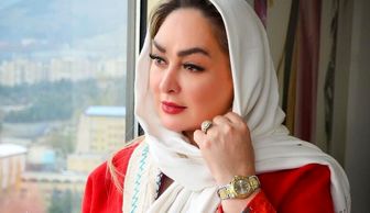 زیر و رو شدن چهره الهام حمیدی
