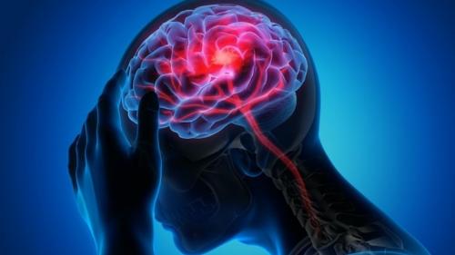  هر۷ دقیقه یک ایرانی دچار آلزایمر می‌شود
