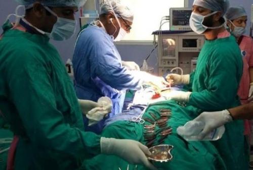  خارج کردن 40 چاقوی فلزی از معده بیمار!