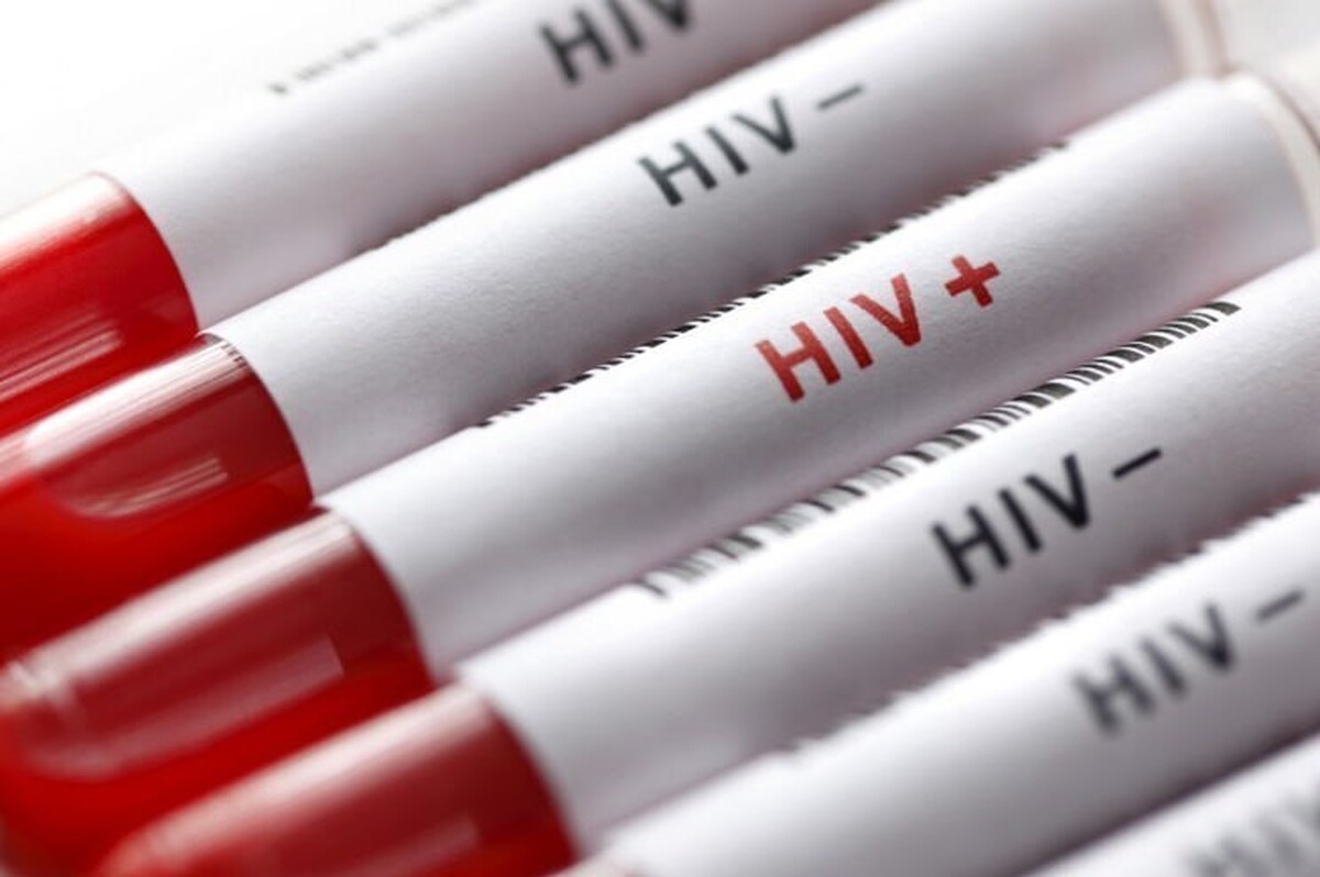 چند نفر در ایران مبتلا به HIV هستند؟ 