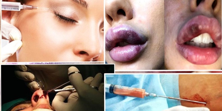 وقتی زور تیغ جراحی بر رژیم‌های لاغری می‌چربد+ عکس