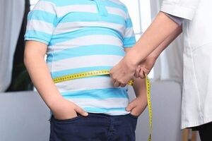  بیش از ۷۰ درصد افراد جامعه چاق هستند