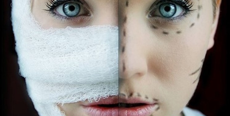  یک شرح حال مستند از قربانیان جراحی‌های زیبایی 