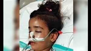 دختر ۴ ساله که نامادری‌اش او را از پله‌ها پرت کرد