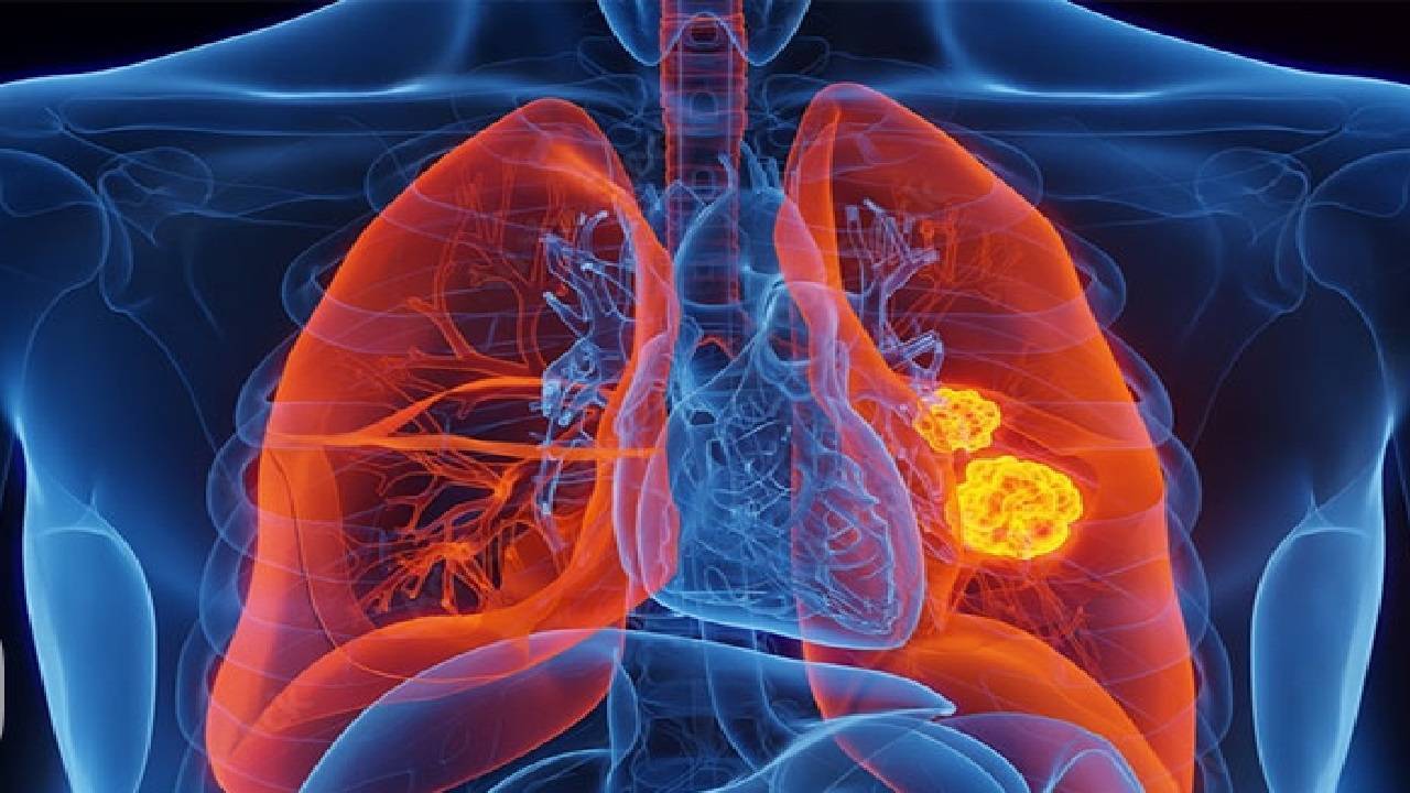 تاثیر رژیم غذایی کم‌چرب 