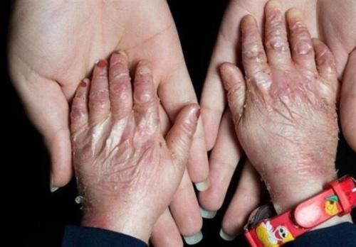 آمریکا در پرونده "تحریم کودکان پروانه‌ای" محکوم شد 