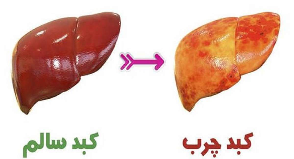 چگونه به کبد خود کمک کنیم؟ 
