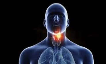 غذاهای مضر برای گلودرد