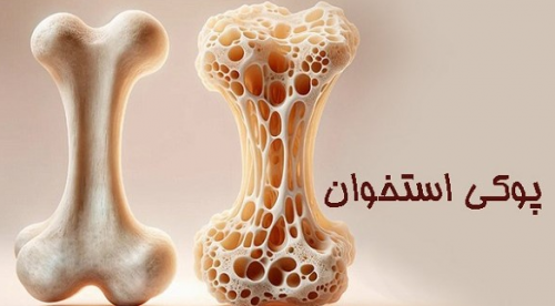 استخوان‌هایتان را با این غذاها محکم کنید