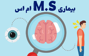بیماری MS ؛ شناسایی ۱۱۲ هزار فرد مبتلا
