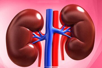 نجات کلیه‌ها از بیماری با این روش