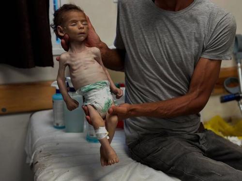 مرگ تدریجی در غزه با سلاح گرسنگی