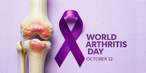 تحرک؛ درمان دردناک التهاب مفاصل