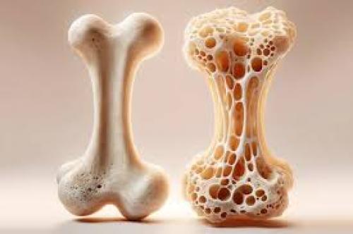  دشمن خاموش سالمندی +عکس