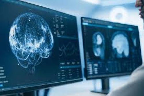 داروی جدیدی برای متوقف کردن آلزایمر 