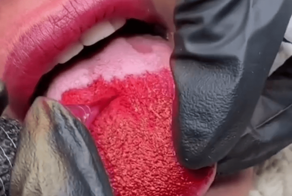 مدی جسورانه با قیمت نابودی سیستم ایمنی+فیلم