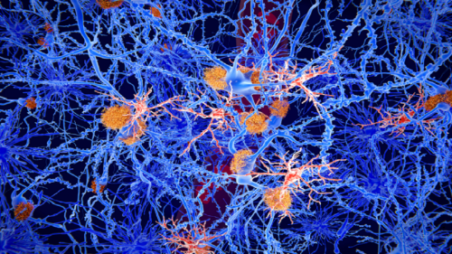 درمانی نوآورانه برای صرع 