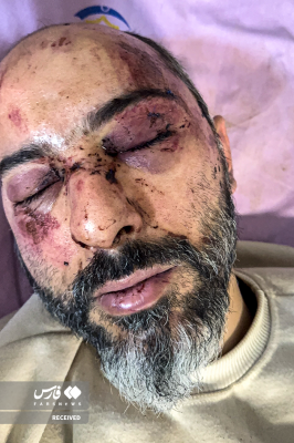 تصاویردردناک ازجنایات اغتشاشگران