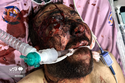 تصاویردردناک ازجنایات اغتشاشگران