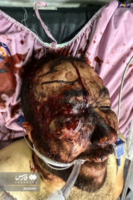 تصاویردردناک ازجنایات اغتشاشگران