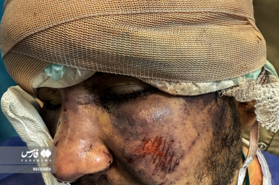 تصاویردردناک ازجنایات اغتشاشگران