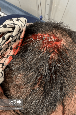 تصاویردردناک ازجنایات اغتشاشگران