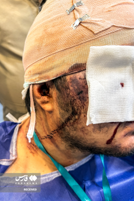 تصاویردردناک ازجنایات اغتشاشگران