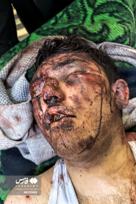 تصاویردردناک ازجنایات اغتشاشگران