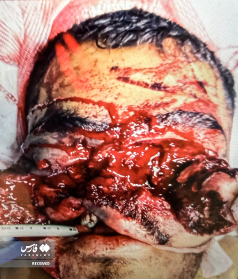 تصاویردردناک ازجنایات اغتشاشگران