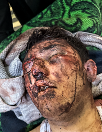 تصاویردردناک ازجنایات اغتشاشگران