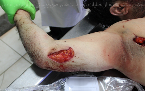 بدن‌هایی که با قمه سوراخ‌سوراخ شده‌اند(۱۸+)/عکس