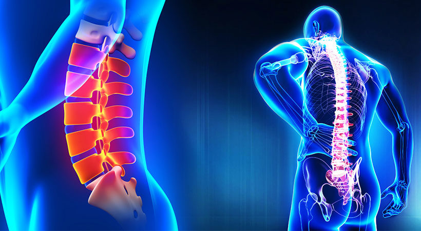 ورزش‌های مناسب بعد از جراحی دیسک کمر 