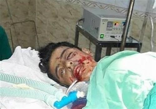حملات موشکی تکفیری‌ها به «نبل و الزهراء»+عکس 