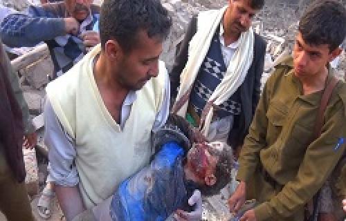 12هزار یمنی در جنگ با سعودی‌ها کشته شدند