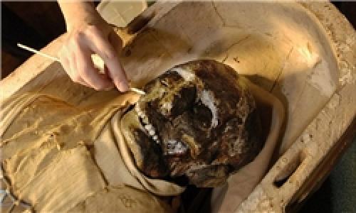  صدور مجوز سقط جنین درمانی 