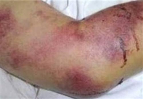 ۶ گروهی که در معرض بیماری کشنده تب کنگو هستند 
