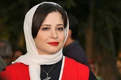  ماجرای زخم روی پیشانی بازیگر زن مشهور
