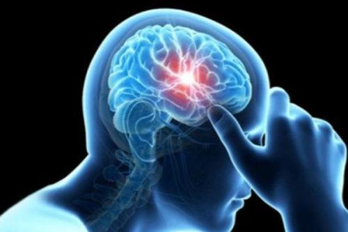 خطر بالای ابتلا به سکته مغزی در زنان باردار